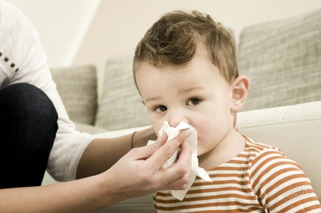Πώς να θεραπεύσει μια ρινική μύτη σε ένα παιδί
