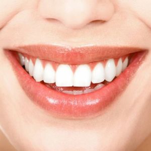 Photo How to whiten your teeth without harm