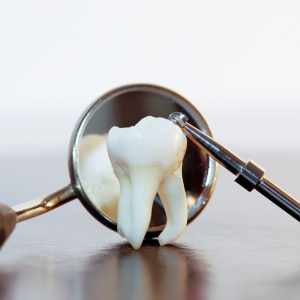 دندان بازنشسته چیست؟