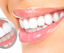 Prevenzione della carie dentale