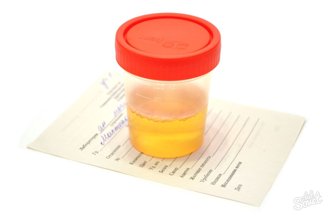 How to collect common urine analysis