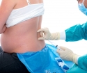 Epidurální anestezie v porodu