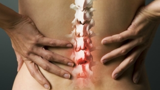 Kaj je osteohondroza?