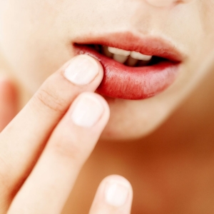 Как лечить простуду на губе