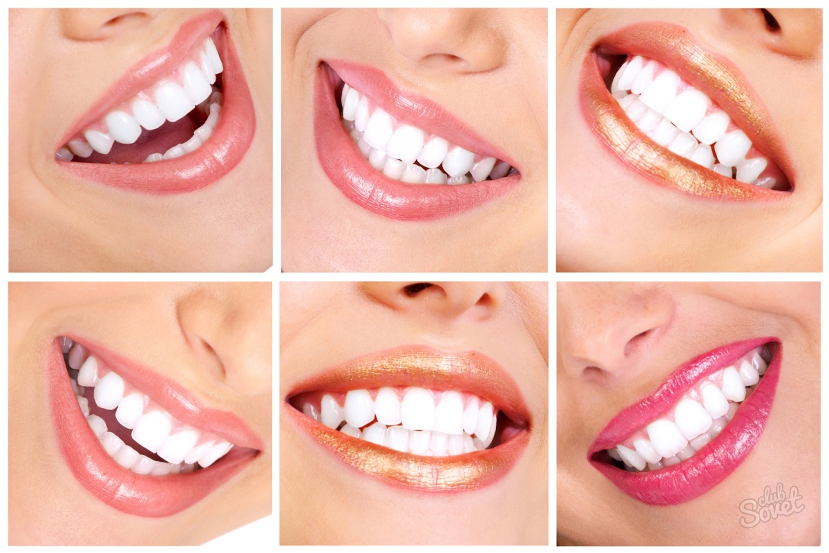 Hur man bleknar dina tänder per dag