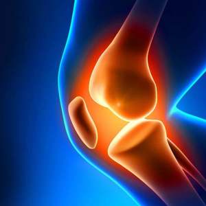 Kaj je artritis?