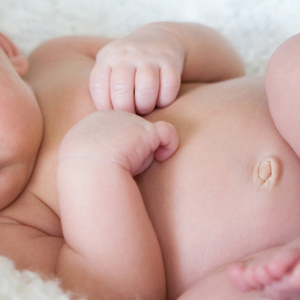 Wie man die Nabelschnur des Neugeborenen verarbeitet