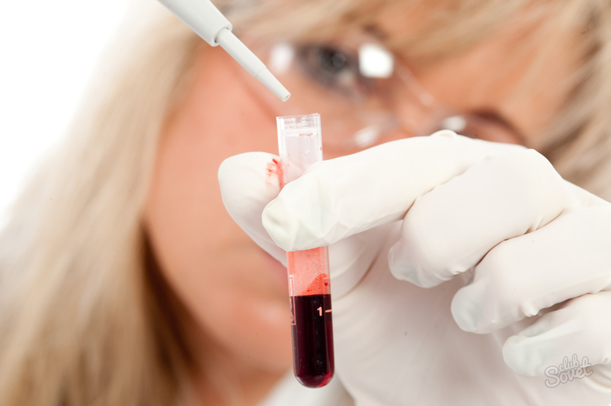 كيفية تحديد فصيلة الدم