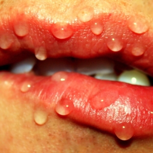 Stock foto yazzovka v ústach: Ako liečiť