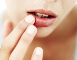 Que de traiter les accrocs sur les lèvres