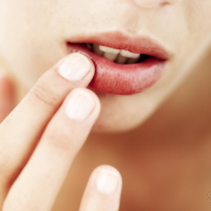 Stock foto ce qui sont traités sur les lèvres
