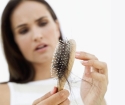 Почему выпадают волосы у женщин