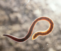 Hur man rengör kroppen från parasiter
