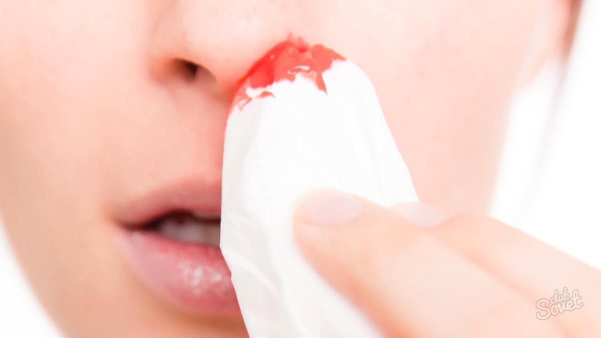 چگونه-برای متوقف کردن خونریزی از بینی