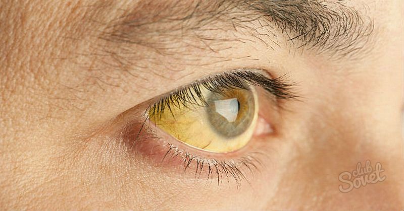دلیل زرد-پروتئین-چشم 1