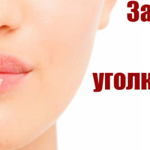 Kaj je prigrizki na ustnicah