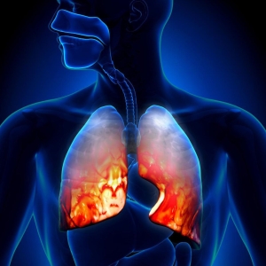 Издърпване на белите дробове - симптоми и лечение