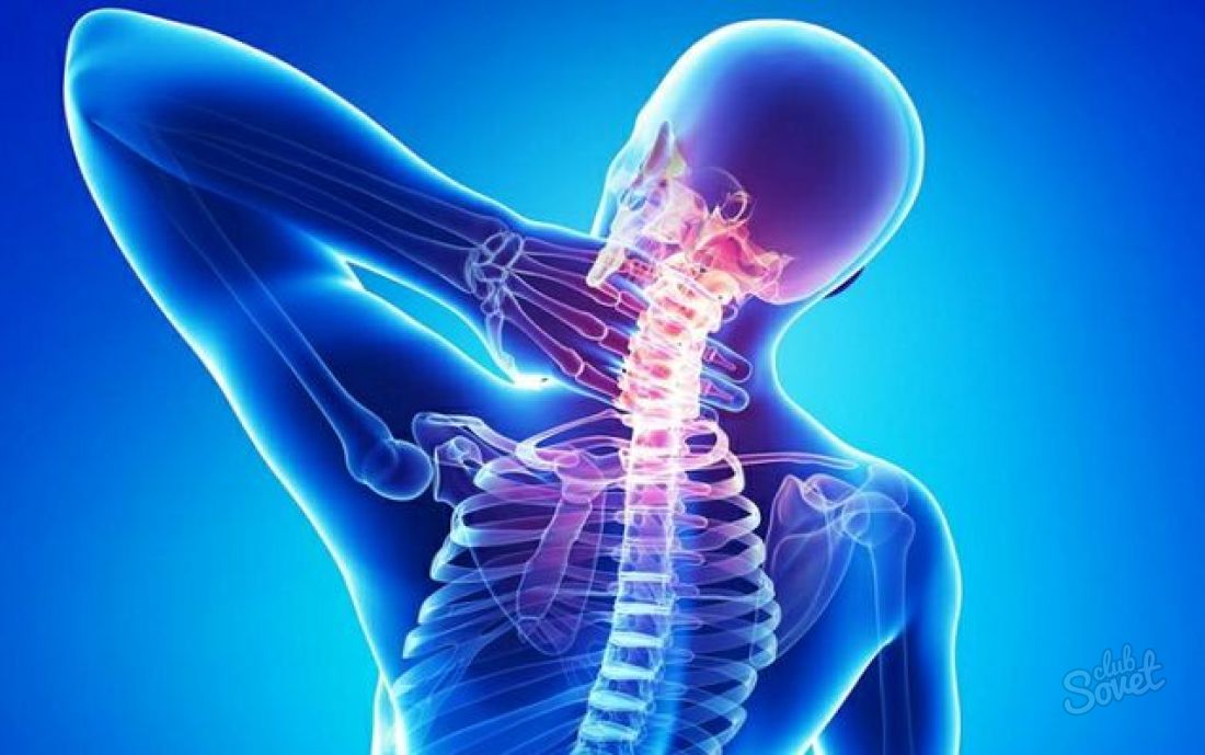 Osteochondróza - Ako liečiť doma