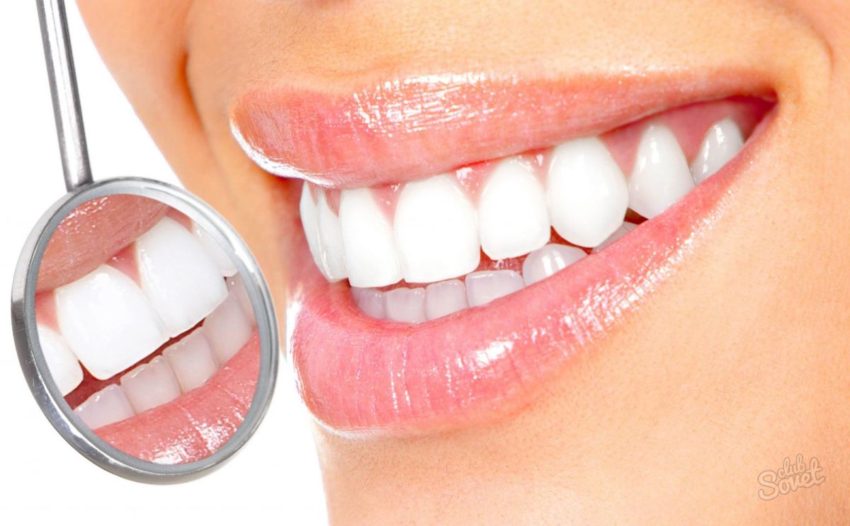 Hogyan fehéríti a fogakat szóda