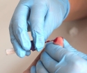 Čo ukazuje všeobecný krvný test