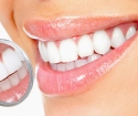 Dişler için beyazlatıcı kalem - doğru veya efsane