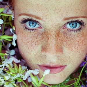 چگونه از شر freckles در خانه خلاص شوید
