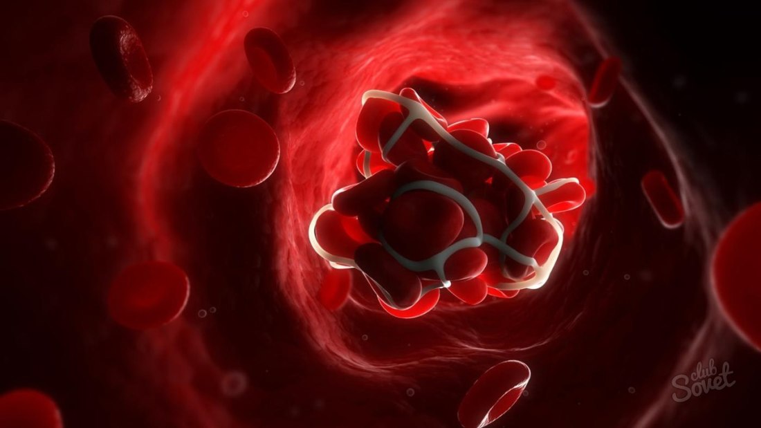 Як знизити гемоглобін в крові