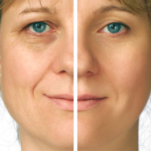 Stock Foto Facial massage against wrinkles