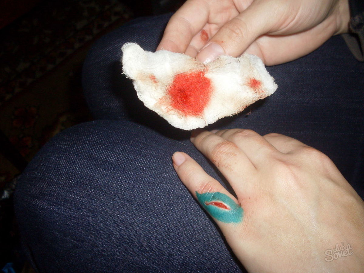 كيف لوقف الدم من الإصبع