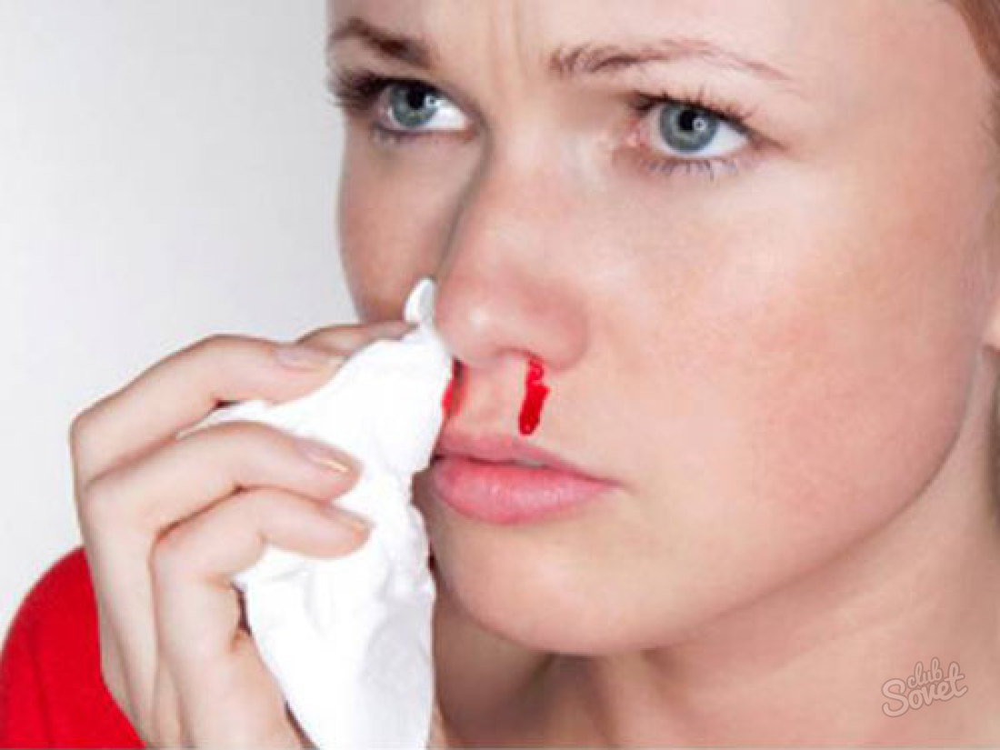 Wie man Blut aus der Nase aufhört