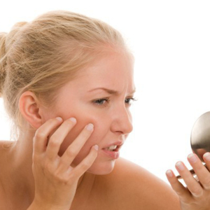 Wie kann man Akne auf dem Gesicht zu Hause loswerden?