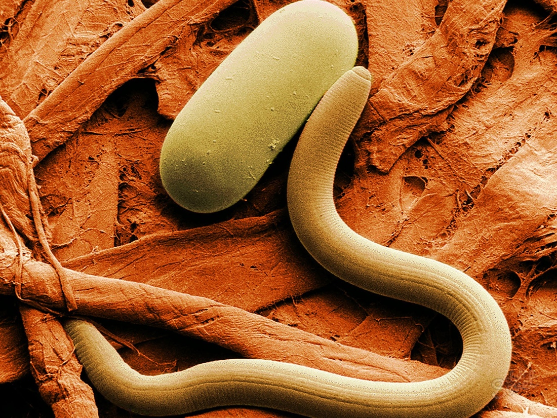 Признаки паразитов в организме