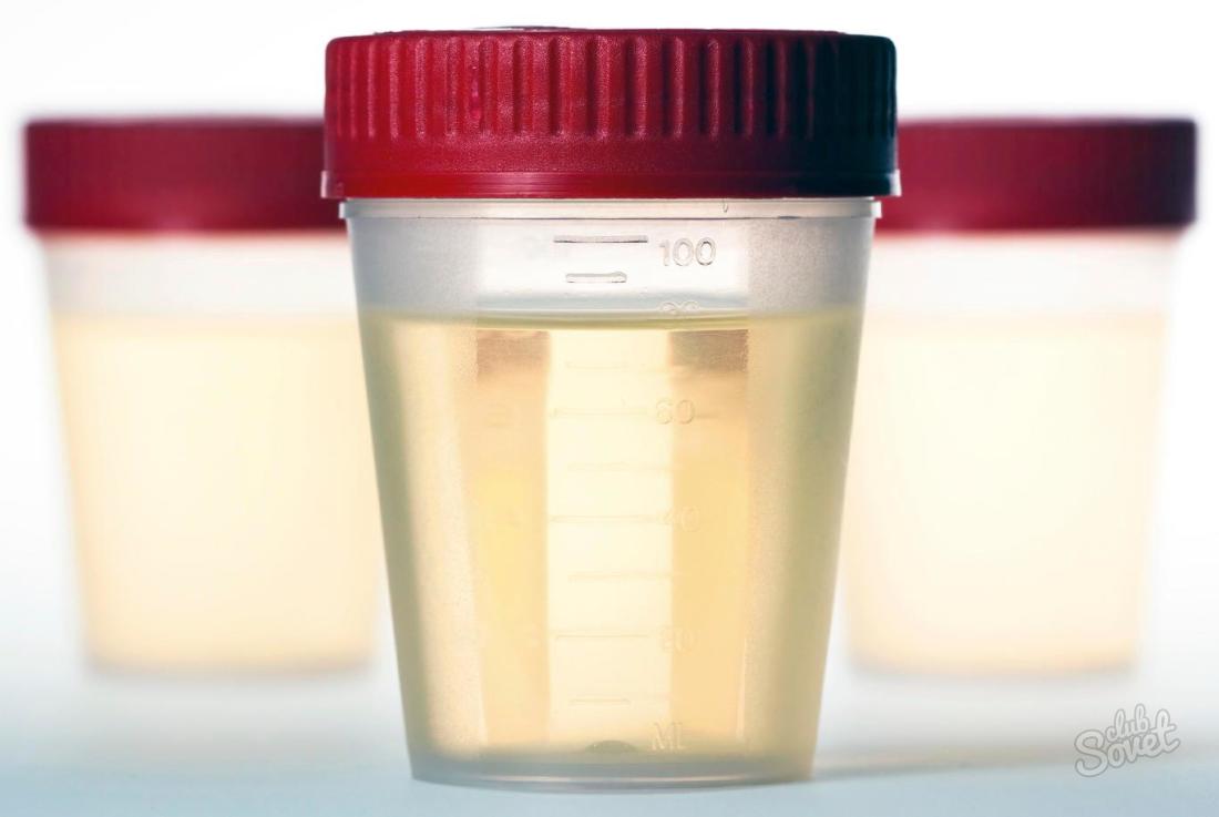 Como coletar urina em nechiporenko