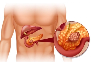 Signs of inflammation of the pancreas