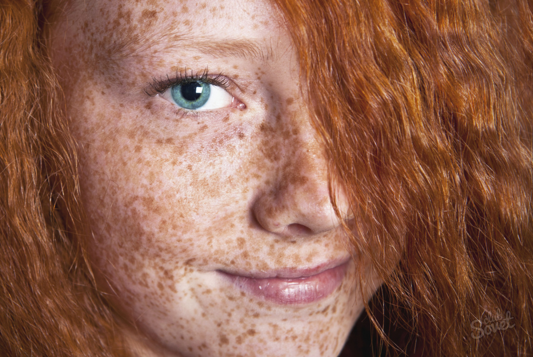 როგორ ამოიღონ freckles