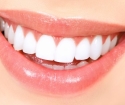 როგორ სწრაფად whiten თქვენი კბილები