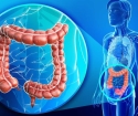 Intestinal ulcer - symptoms and treatment
