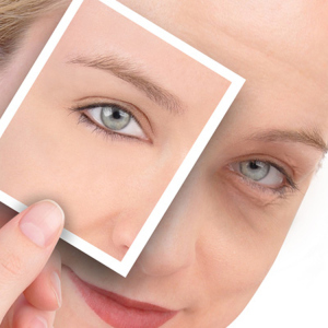 Photo bags under the eyes causes and treatment