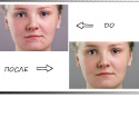 How to remove acne in photoshop