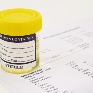 What shows the overall urine analysis