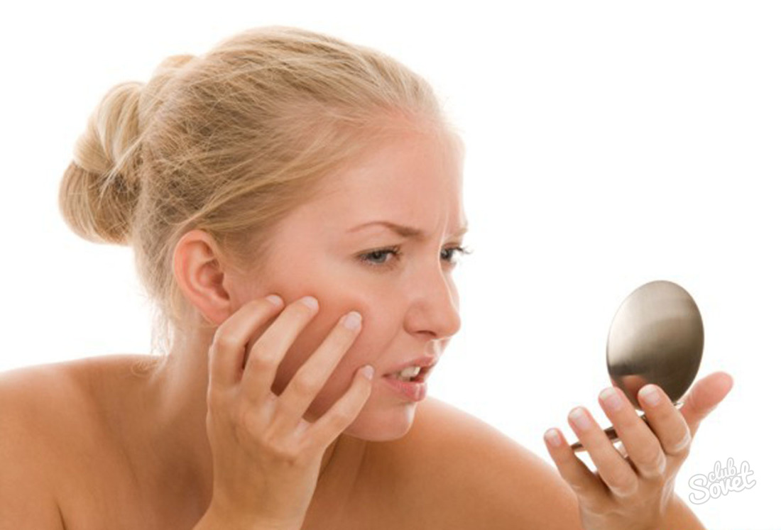 Come sbarazzarsi di acne sul viso a casa