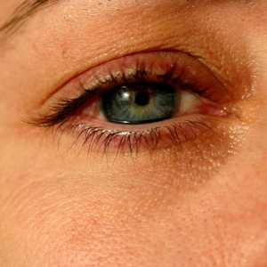 Stock Foto Чорні очі - Як лікувати вдома