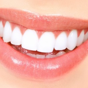 Photo How to quickly whiten your teeth