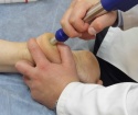 Treatment of Spur shock-wave therapy