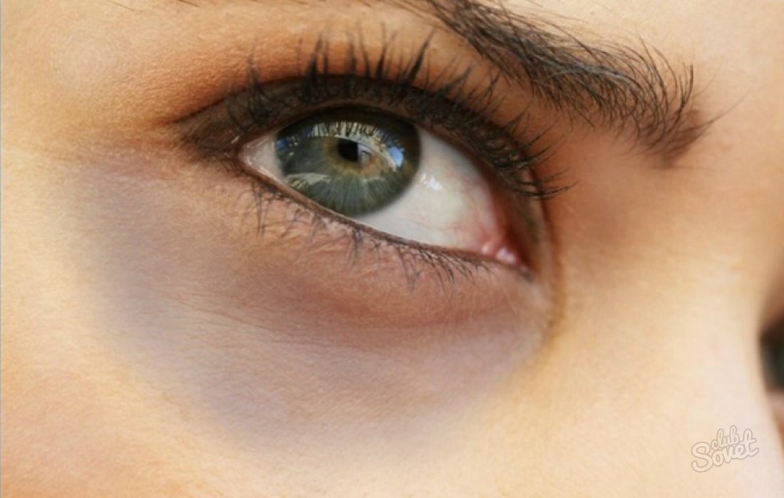 How to get rid of dark circles under the eyes