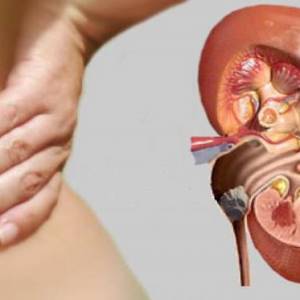 Stock Foto How to withdraw a stone from the ureter