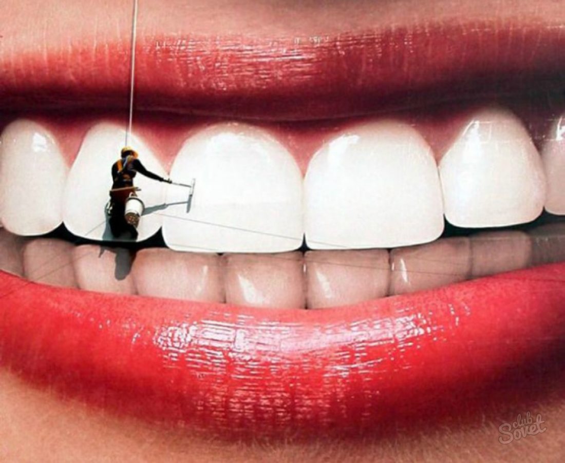 როგორ გააკეთოთ კბილები თეთრი?