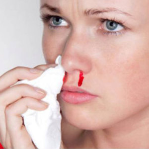 Como parar o sangue do nariz