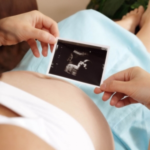 37 Týždeň tehotenstva - Čo sa stane?
