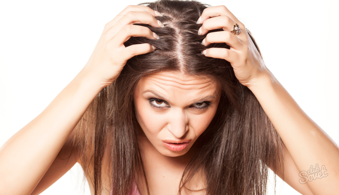 Seborrheic dermatitis of the scalp